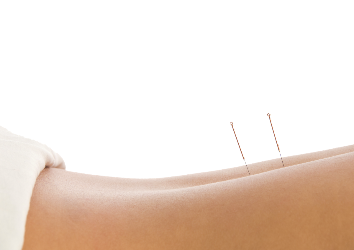 Acupuncture – treatment of pain and injuries at the Foundry Clinic